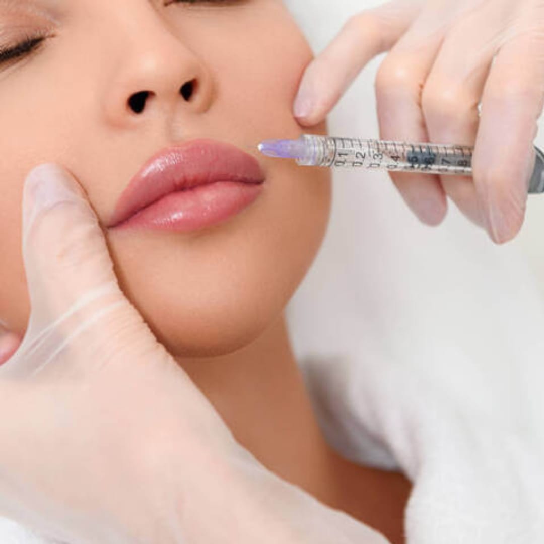 Preenchimento Labial